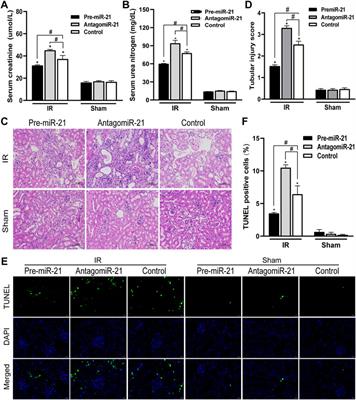 Gender Differential Expression of AR/miR-21 Signaling Axis and Its Protective Effect on Renal Ischemia-Reperfusion Injury